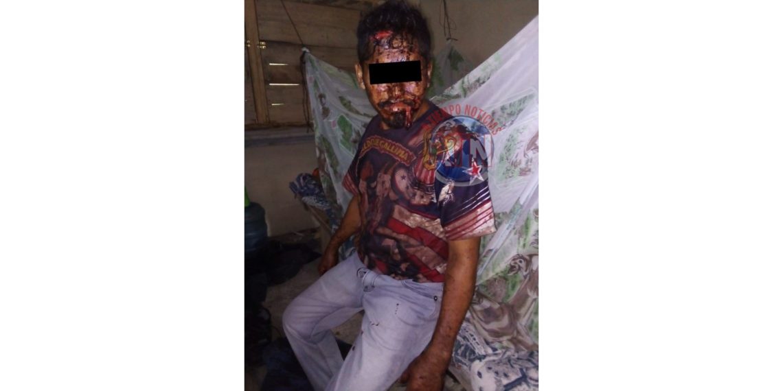 En riña casi matan a guatemalteco