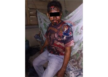 En riña casi matan a guatemalteco