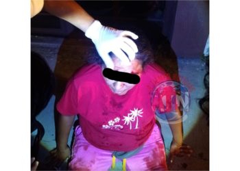 Ebria Mujer chocó contra vehículo estacionado