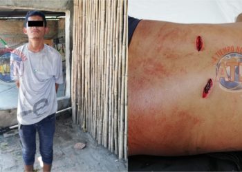 Lesionan a panadero en Puerto Madero