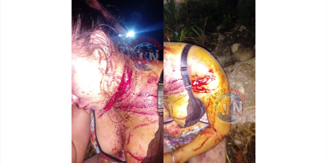 Buscan a taxista que lesionó e intentó abusar de una mujer