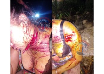 Buscan a taxista que lesionó e intentó abusar de una mujer