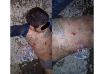 Lesionan a salvadoreño en Raymundo Enríquez