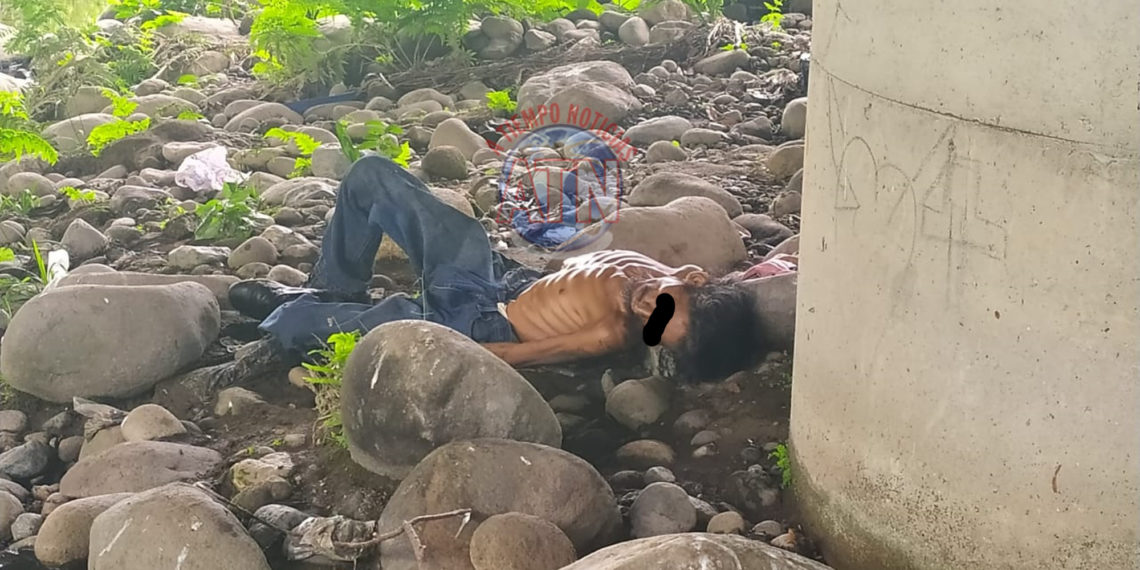 Muere indigente y está en calidad de desconocido