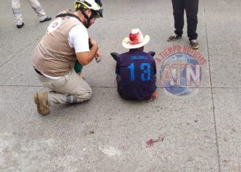 Se cayó y se lastimó la cabeza