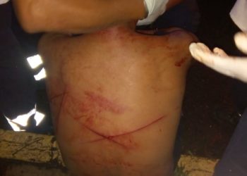 Dos lesionados en una riña