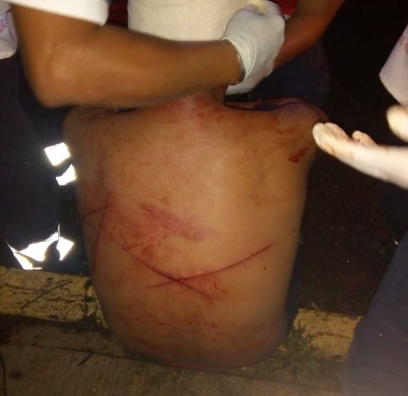 Dos lesionados en una riña