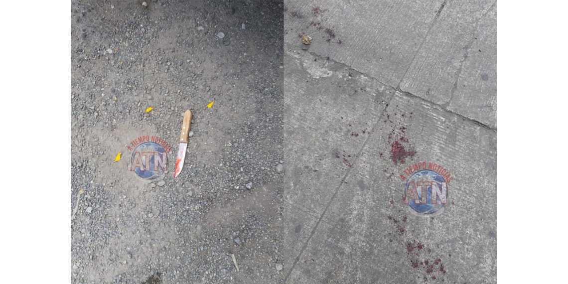 Dos detenidos al protagonizar una riña que dejo dos lesionados en la COMAR