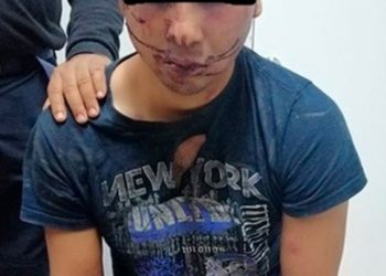 Joven que atacó a sus abuelos se encontraba en un anexo