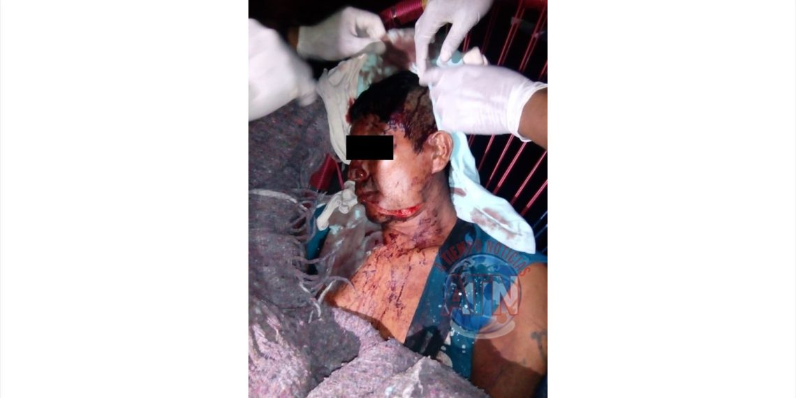 Casi lo matan a machetazos