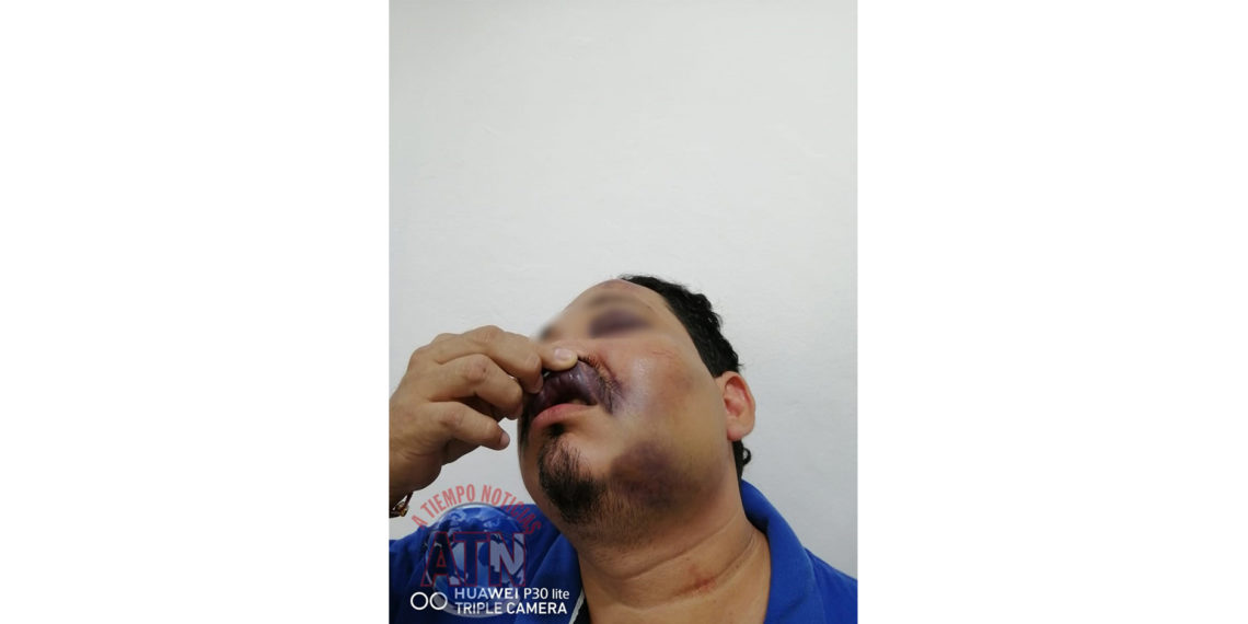 Guardias de seguridad del Bar Abolengo golpearon a un parroquiano el pasado fin de semana