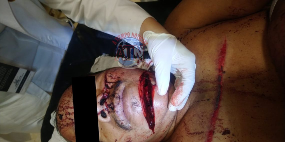 Lo machetearon en el interior de su casa