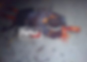 Fue macheteado y falleció en el hospital general de Tapachula