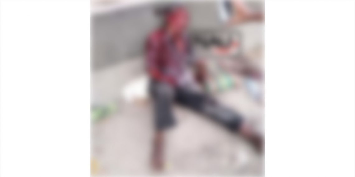 A machetazos le quitaron la mano