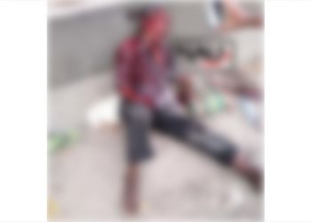 A machetazos le quitaron la mano