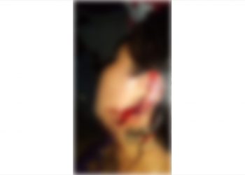 Su vecino los lesionó con un machete en Tuxtla Chico