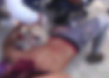 En asaltó lesionan a un migrante hondureño