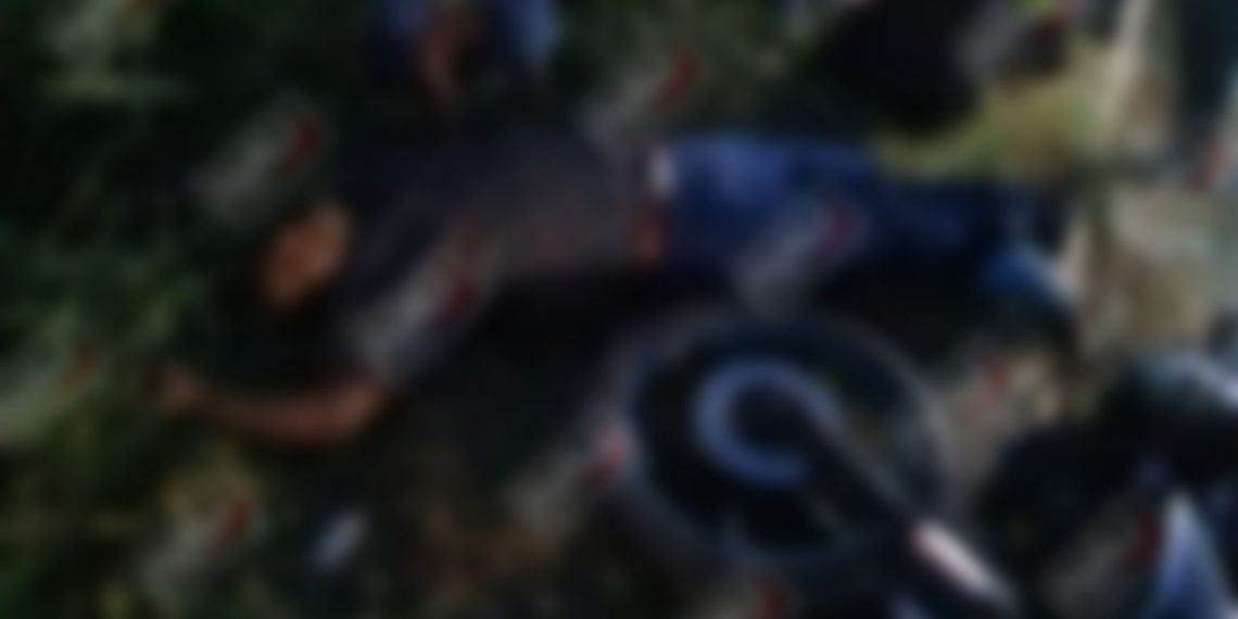 Pierde el pie derecho al ser impactado por un vehículo