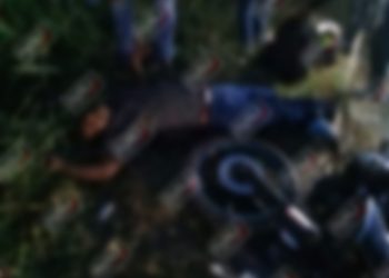 Pierde el pie derecho al ser impactado por un vehículo