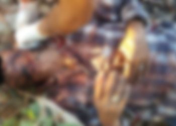 En asalto fue lesionado de un machetazo en la cara