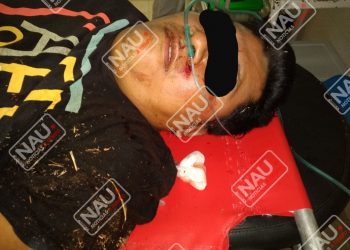 Una persona se encuentra grave en el hospital rural de Mapastepec