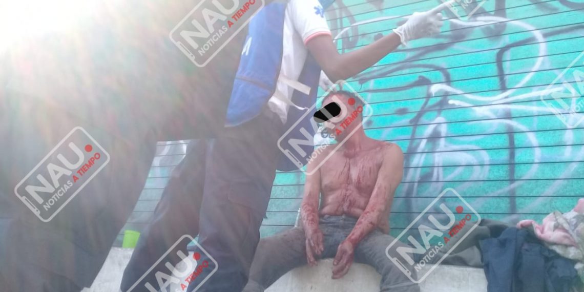 Peleaban una botella de licor de caña