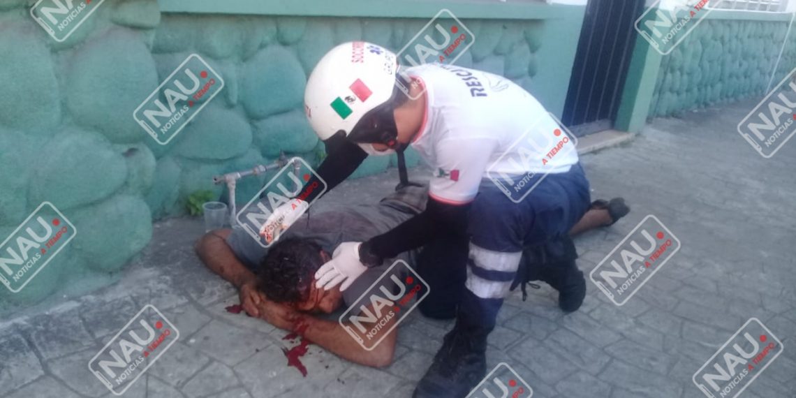 Salvadoreño fue golpeado en la cabeza para robarle sus pertenencias