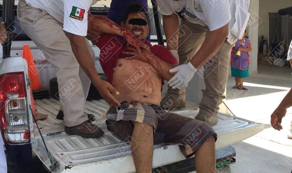 Le dieron dos balazos al oponerse a ser asaltado