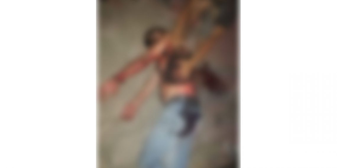 Lesionan a hondureño en riña frente al albergue Jesús el Buen Pastor