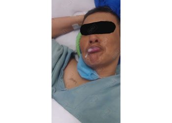 El hospital general de Tapachula sigue siendo hospital de la muerte