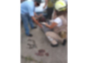 Cayó de su propia altura y se hizo una herida en la cabeza