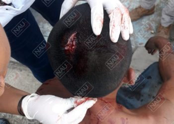 Cayó de su propio peso