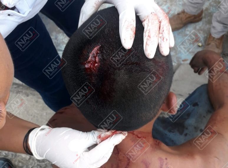 Cayó de su propio peso