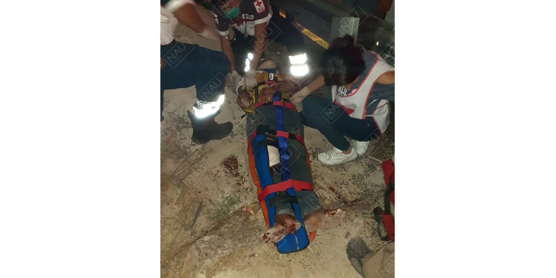 Tráiler atropella un semoviente y le cae encima a un motociclista en carril contrario