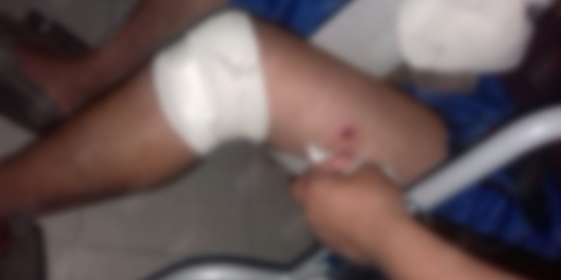 En Violento Asalto Lesionan A Una Persona