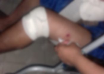 En Violento Asalto Lesionan A Una Persona