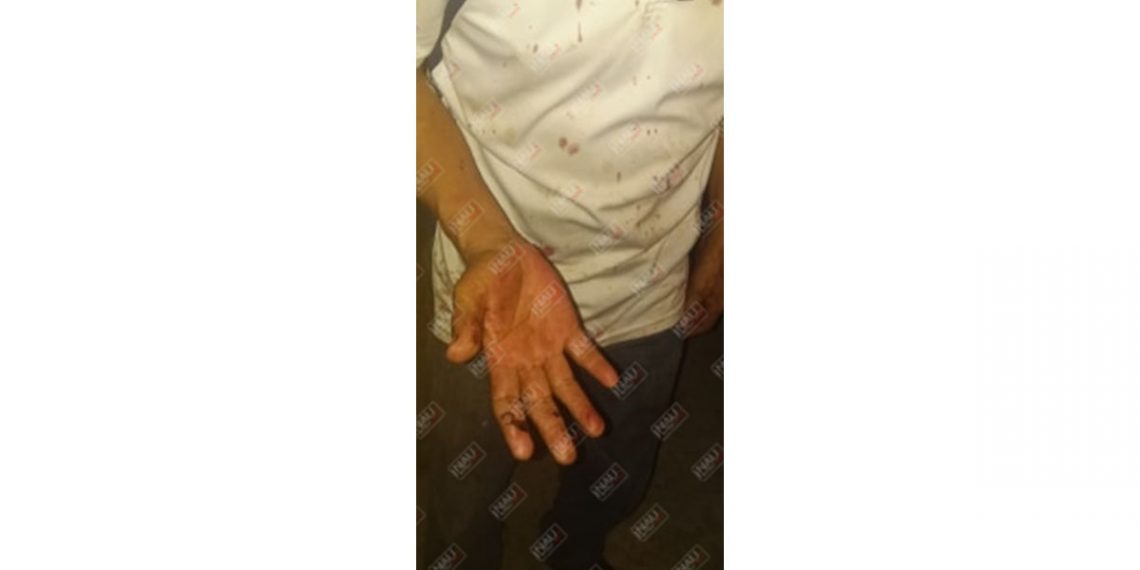 Asaltan y lesionan a un taxista en la entrada a la colonia el Rosario