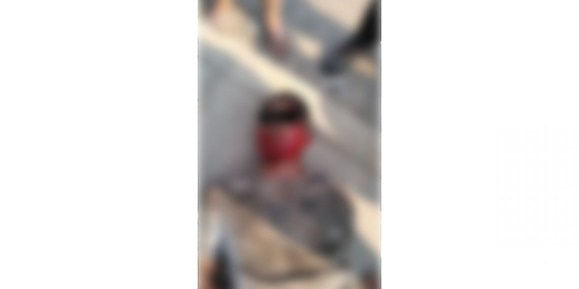 Rescatan a menor linchado por entrar a robar a dos casas en el Fraccionamiento San Jorge