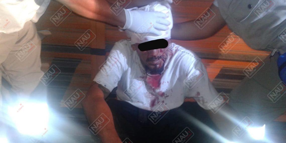 Presunto Barrio 18 de la Clica Vatos Locos, fue lesionado de un machetazo en la cabeza