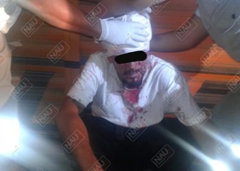 Presunto Barrio 18 de la Clica Vatos Locos, fue lesionado de un machetazo en la cabeza