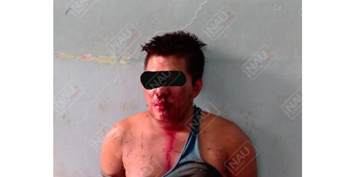 Golpean a una persona que presuntamente entró a robar a una casa