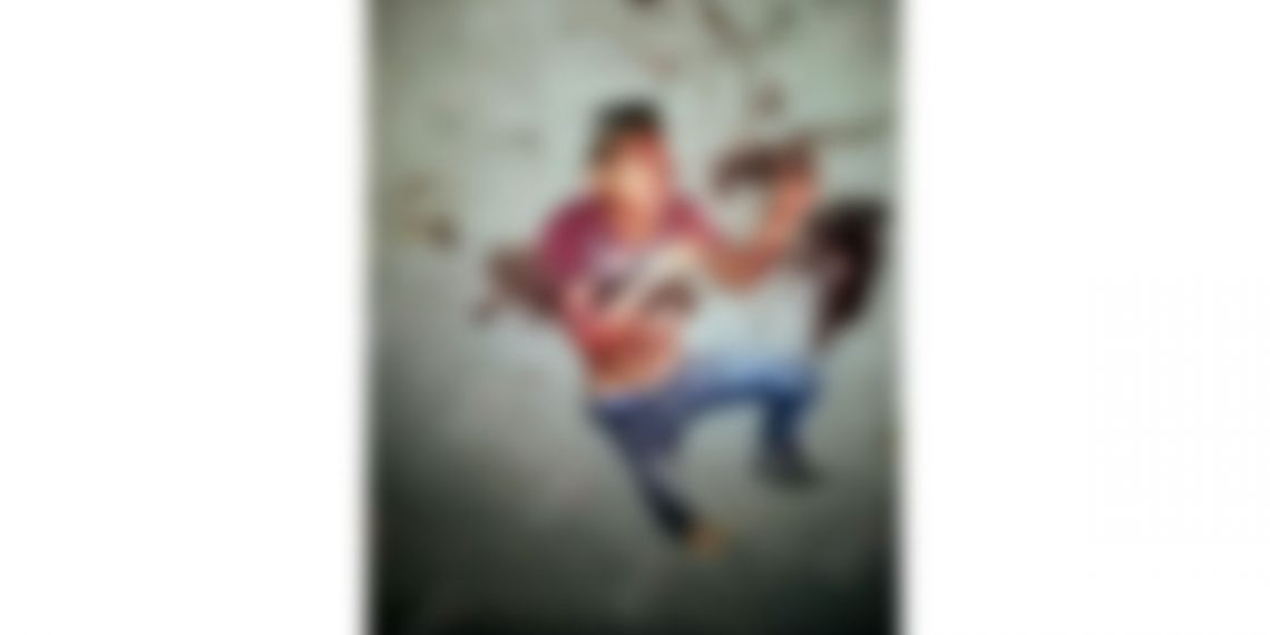 Tras casi un mes de estar internado le amputan el ante brazo izquierdo