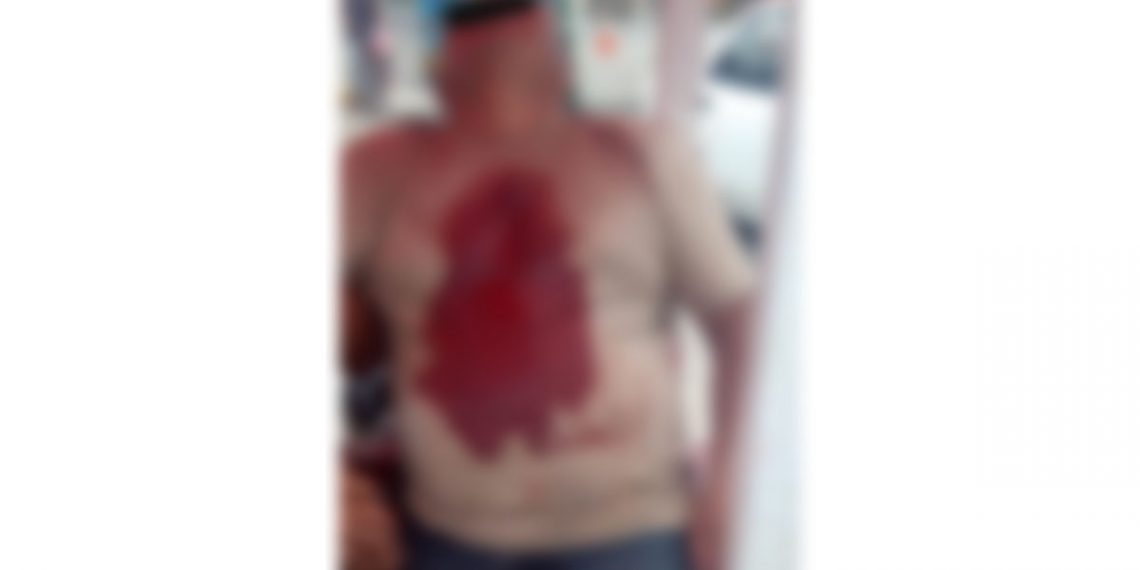 Le dejaron una navaja en el pecho