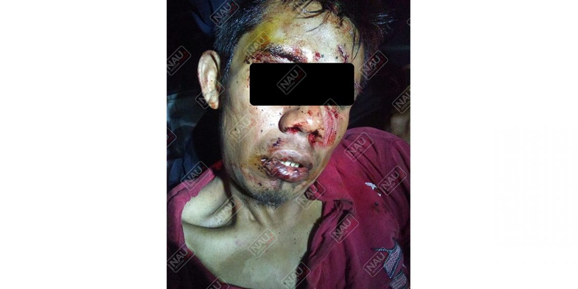 El mango se fugó del HGT