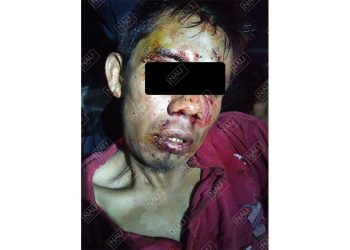 El mango se fugó del HGT