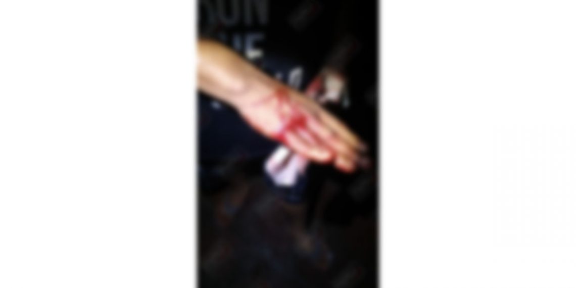 Lo reportaron que había sido lesionado con arma blanca