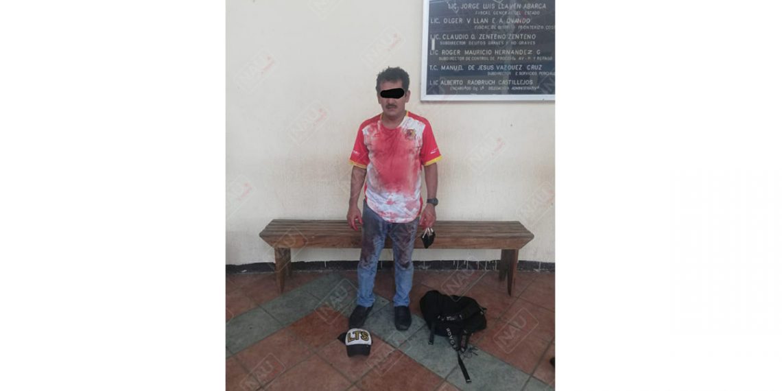 Mujer acuchillada por su esposo falleció en el Hospital general de Tapachula