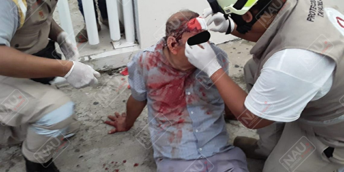 Lo lesionaron al oponerse a ser asaltado