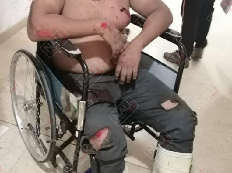 Atropellado quedó tirado en el pavimento de la carretera Tapachula – Puerto Madero