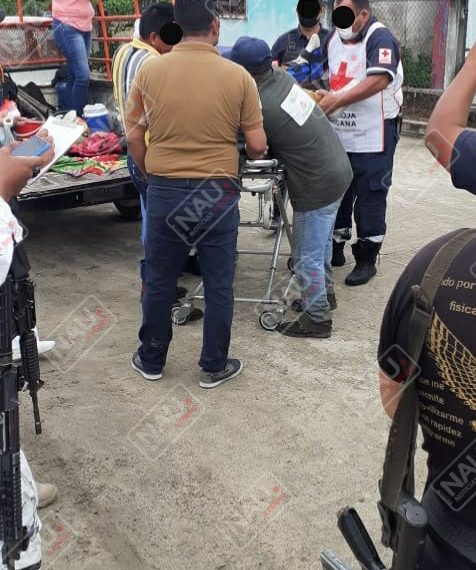 Le metieron un balazo para robarle su motocicleta